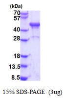 Human NDRG3 Protein (Recombinant His)