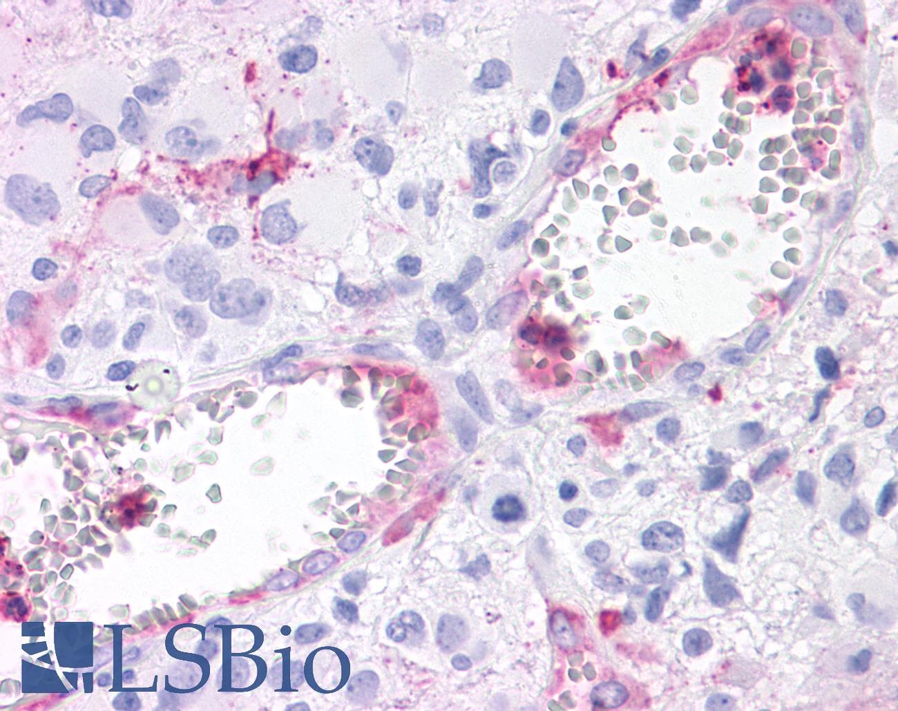 PathPlus™ Polyclonal Rabbit anti-Human RORC / ROR Gamma Antibody (Ligand-binding Domain, IHC)