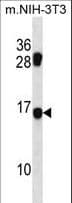 MECOM / EVI1 Antibody (aa81-109)