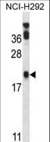 PERP Antibody (aa162-191)