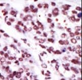 PRKCE / PKC-Epsilon Antibody (aa206-236)