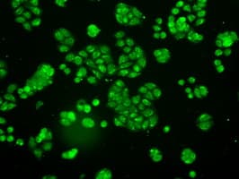 NTRK3 / TRKC Antibody (clone OTI24B3)