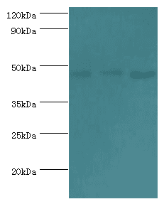 Polyclonal Rabbit anti-Human BAF53B / ACTL6B Antibody (aa1-280, IHC, WB)