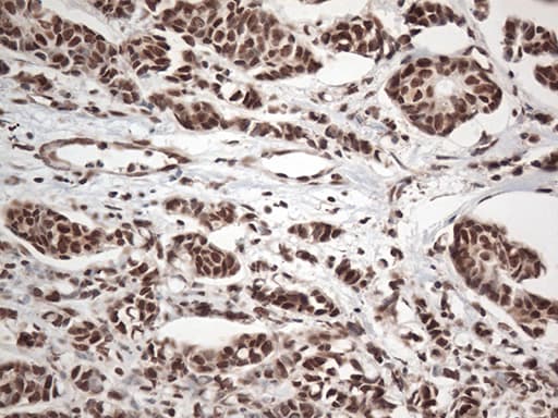 Monoclonal Mouse anti-Human EWSR1 / EWS Antibody (clone OTI2G3, Carrier-free, aa256-447, IHC, WB)