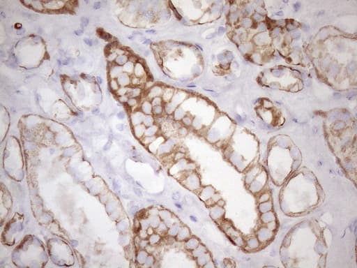 KRT18 / CK18 / Cytokeratin 18 Antibody (aa69-372, clone OTI3D1)