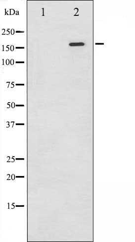 EGFR Antibody (phospho-Tyr1197)