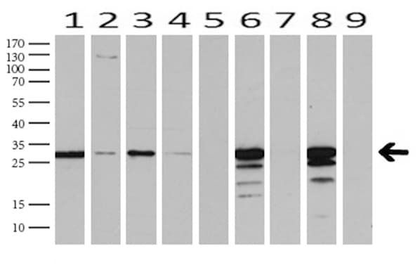 LGALS3 / Galectin 3 Antibody (clone UMAB189)