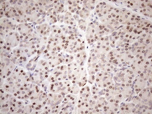 Monoclonal Mouse anti-Human AAAS / Adracalin Antibody (clone OTI5B10, aa322-546, IHC, WB)
