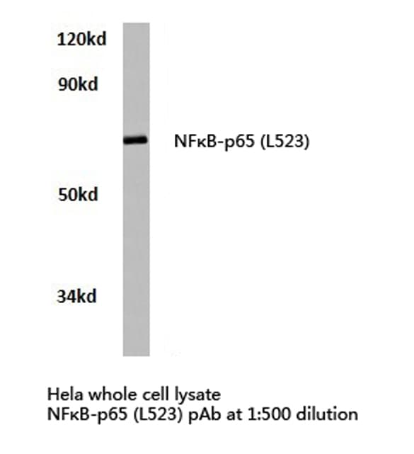 RELA / NFKB p65 Antibody (Leu523)