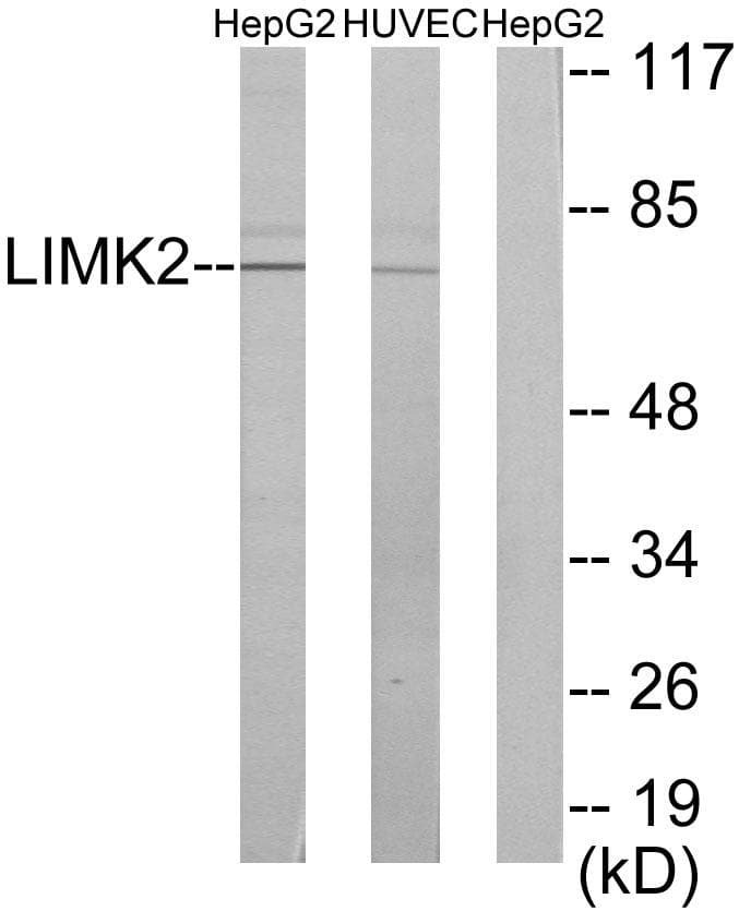 Polyclonal Rabbit anti-Human LIMK2 Antibody (IHC, IF, WB)