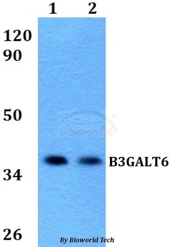 B3GALT6 Antibody