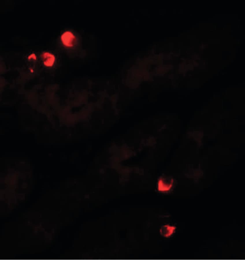 SGK1 / SGK Antibody