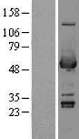 Human ALDH3A1 Protein (Over-Expression Lysate Myc-DDK (Flag))