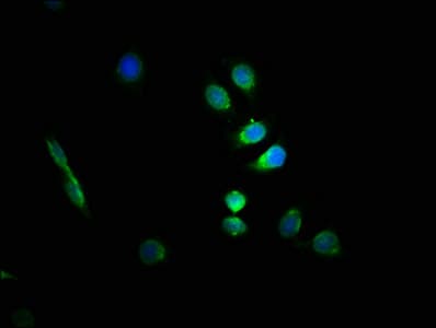 GFAP Antibody