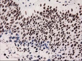 CTDSP1 / SCP1 Antibody (clone OTI1G1)