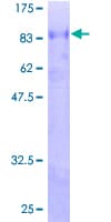 Human ZSCAN18 / ZNF447 Protein (Recombinant GST)