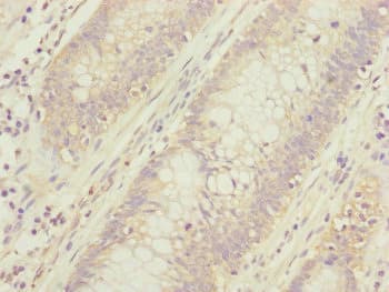 CEP95 / CCDC45 Antibody