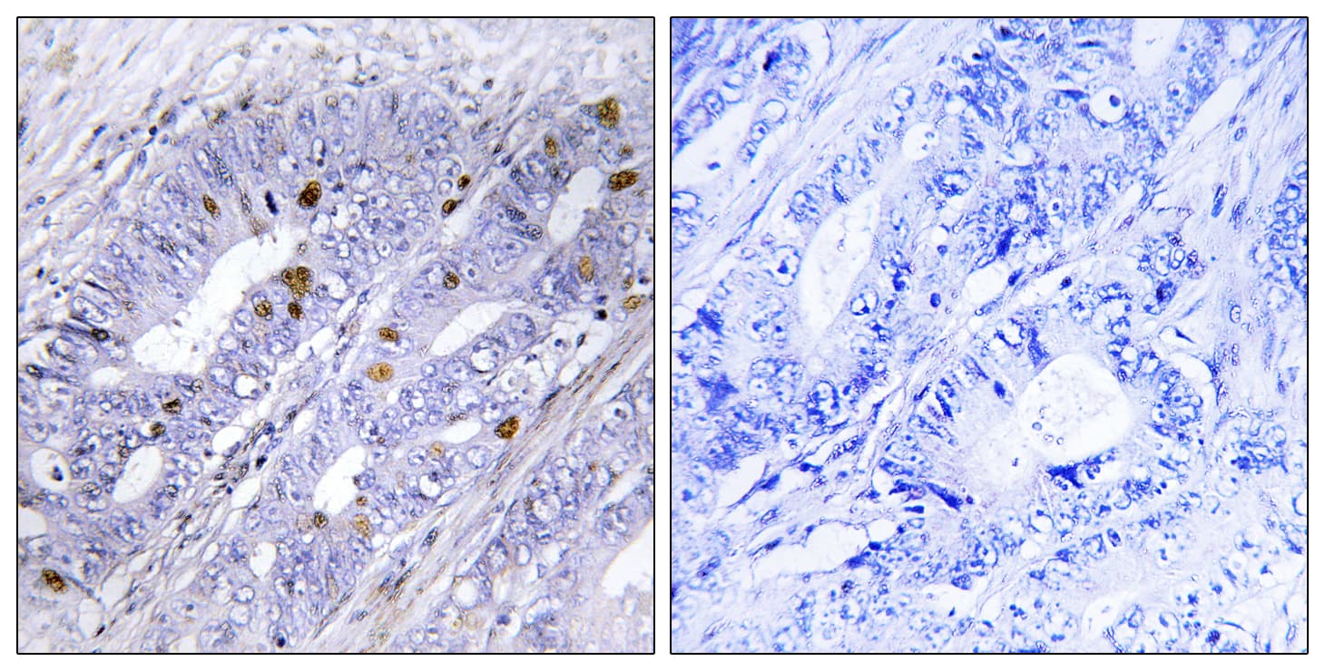 NR4A1 / NUR77 Antibody (aa317-366)