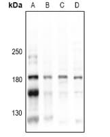 Polyclonal Rabbit anti-Human CD45 / LCA Antibody (WB)