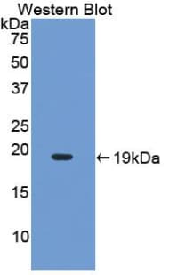 IL17 Antibody (aa20-155)