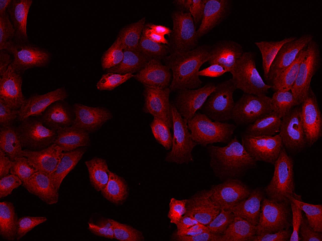 Polyclonal Rabbit anti-Human DPYSL2 / CRMP2 Antibody (IF, WB)