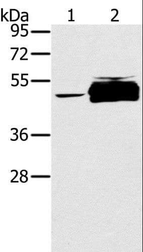 Polyclonal Rabbit anti-Human PTPN20 Antibody (IHC, WB)