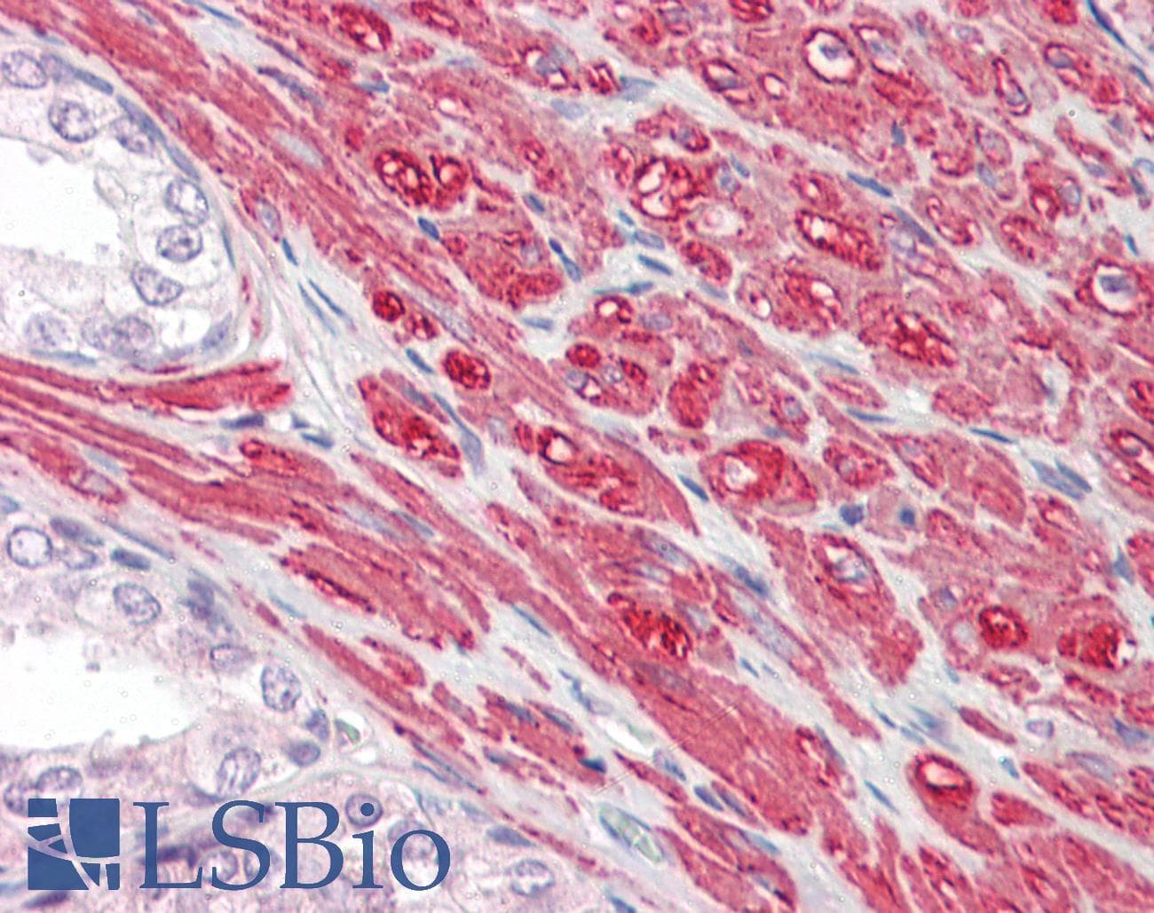 IHC-plus™ Polyclonal Rabbit anti-Human GREM2 / Gremlin 2 Antibody (IHC)