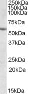 IHC-plus™ Carboxylesterase 1 / CES1 Antibody (aa533-544)