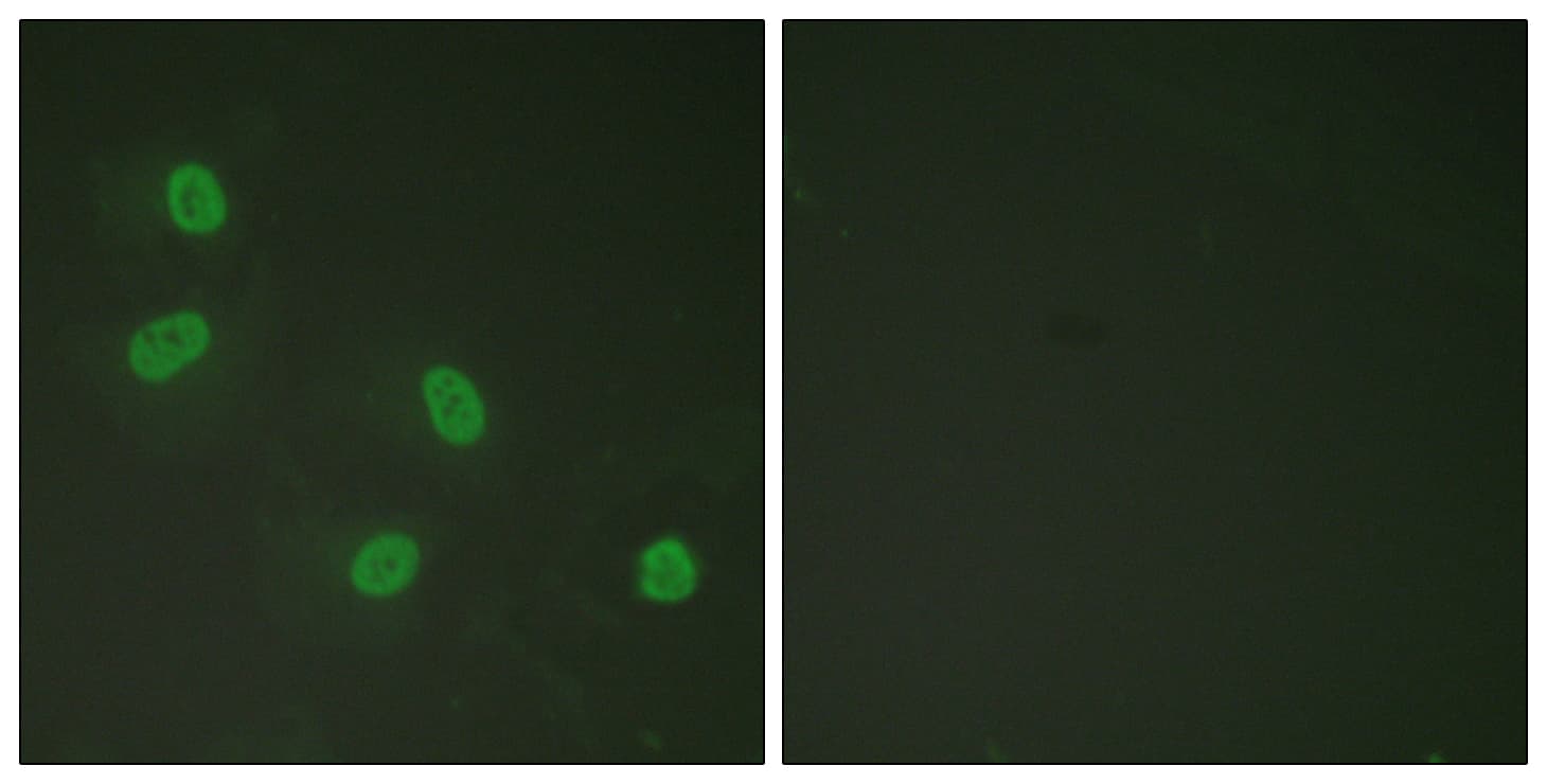 MED1 / TRAP220 Antibody (phospho-Thr1457)