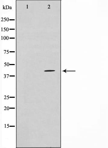 TBX1 Antibody