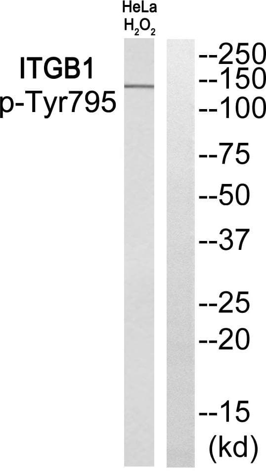 ITGB1 / Integrin Beta 1 / CD29 Antibody (phospho-Tyr795)
