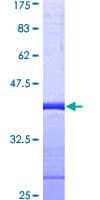 Human SPT5 / SUPT5H Protein (Recombinant GST, N-terminus)