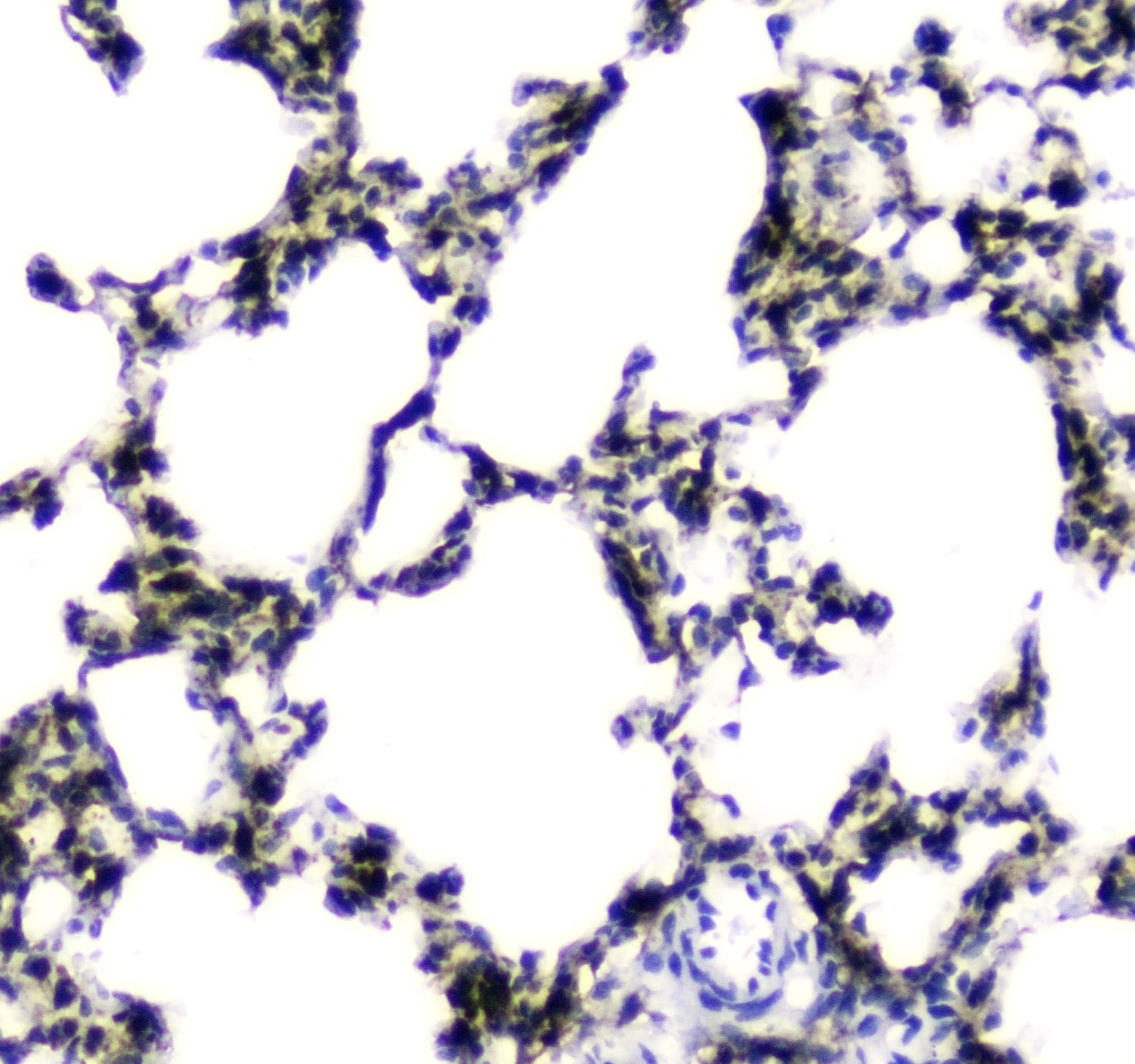 Carboxylesterase 1 / CES1 Antibody