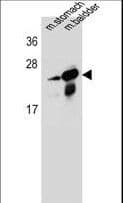 RAB25 Antibody (aa113-141)