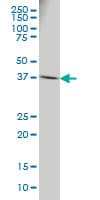 RPSA / Laminin Receptor Antibody (clone 8G4)
