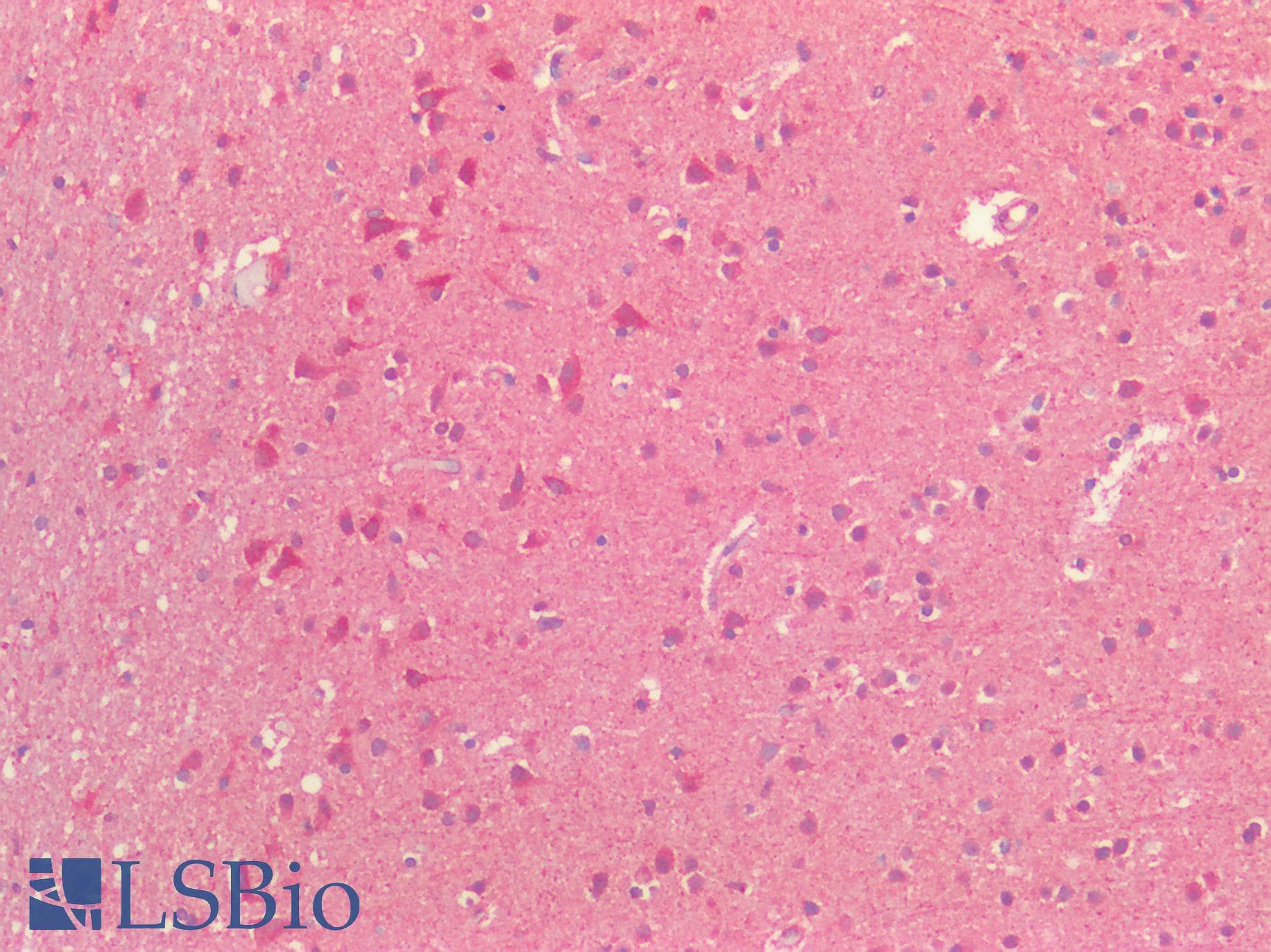 PathPlus™ TUBB / Beta Tubulin Antibody (aa174-428)