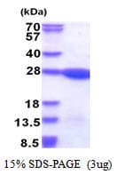Human LZIC Protein (Recombinant His)