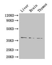 HAVCR1 / KIM-1 Antibody (aa21-290)