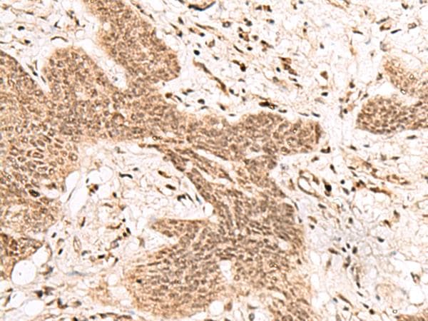 Polyclonal Rabbit anti-Human FAM111B Antibody (IHC)