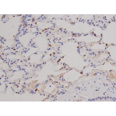 FAK / Focal Adhesion Kinase Antibody (phospho-Tyr576)