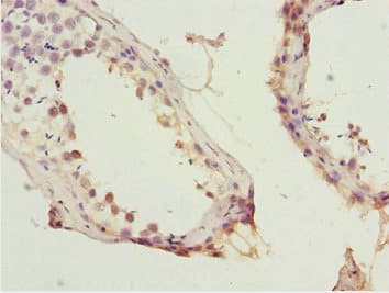 Polyclonal Rabbit anti-Human KPNA5 Antibody (IHC, WB)