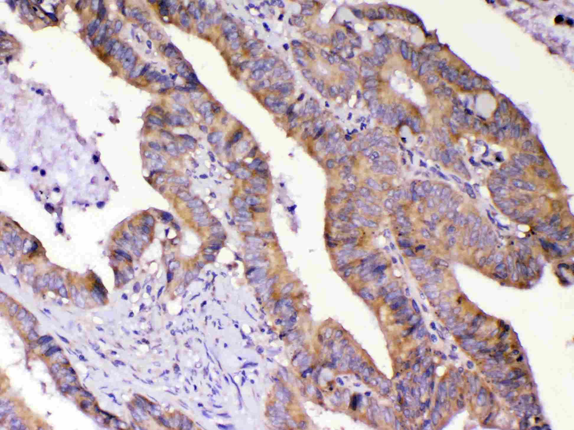 AMD / AMD1 Antibody