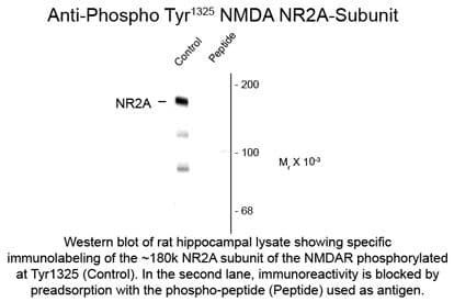 Polyclonal Rabbit anti-Rat GRIN2A / NMDAR2A / NR2A Antibody (phospho-Tyr1325, WB)