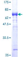 Human ALDOC / Aldolase C Protein (Recombinant GST)