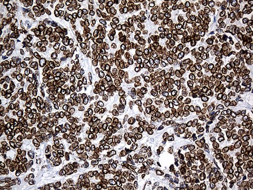SLU7 / 9G8 Antibody (aa1-300, clone OTI6B1)