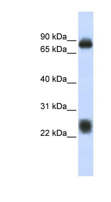 Polyclonal Rabbit anti-Human CO-029 / TSPAN8 Antibody (aa108-157, WB)