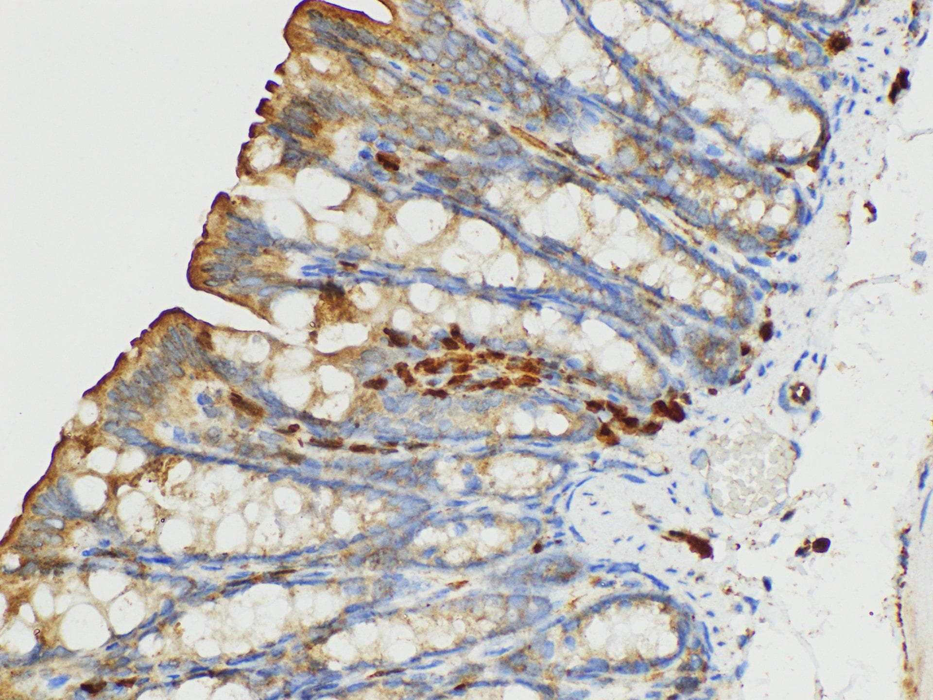 S100A4 / FSP1 Antibody