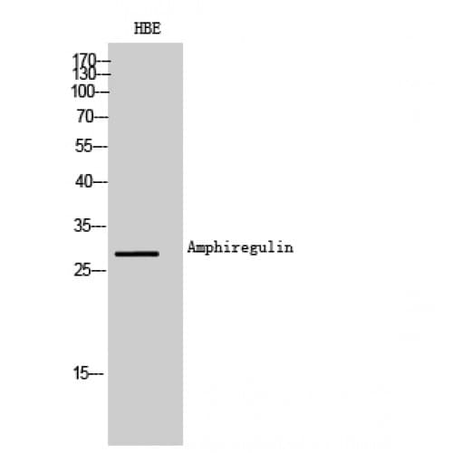 AREG / Amphiregulin Antibody (91-140 aa, Internal)