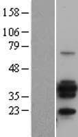 CD20 Protein (Over-Expression Lysate Myc-DDK (Flag))