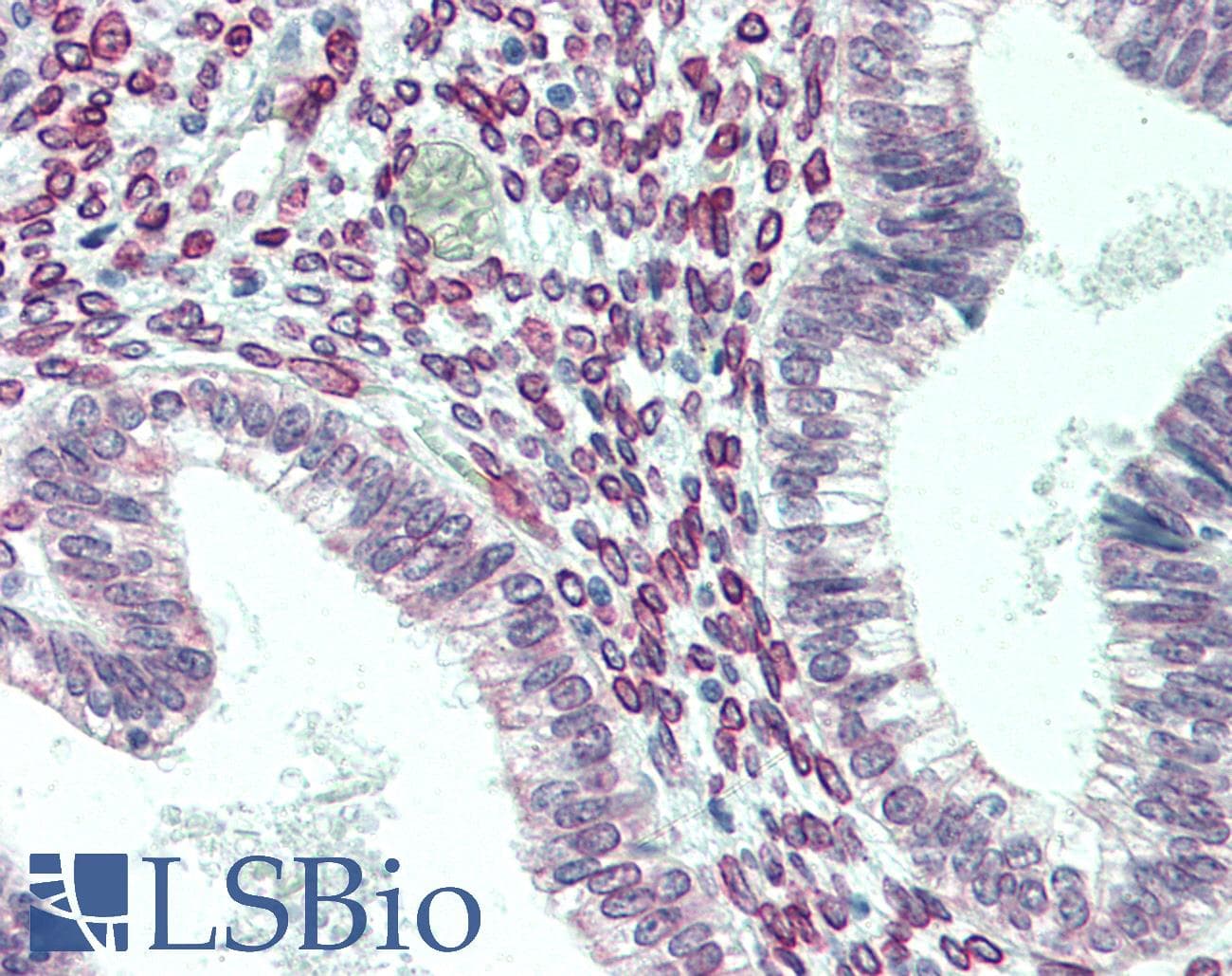 IHC-plus™ Monoclonal Mouse anti-Human CENPF / CENP-F Antibody (aa1759-2093, IHC, WB)